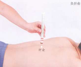 慢性肝炎的艾灸疗法