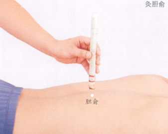 胆石症的艾灸疗法