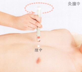 消化性溃疡的艾灸疗法