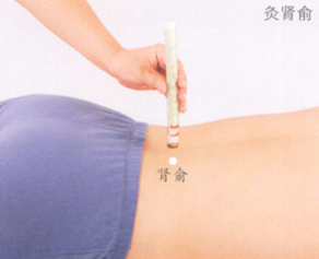 慢性腰肌劳损的艾灸疗法