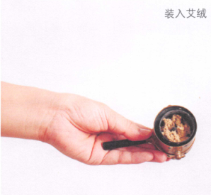 慢性腰肌劳损的艾灸疗法