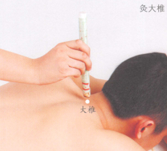 颈椎病的艾灸疗法