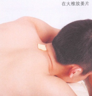 颈椎病的艾灸疗法