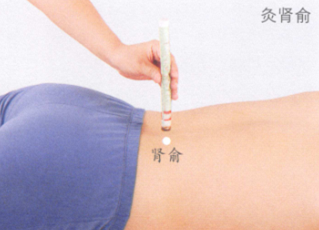 腰腿痛的艾灸疗法