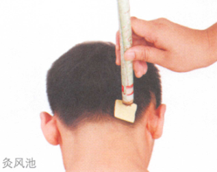 感冒的艾灸疗法