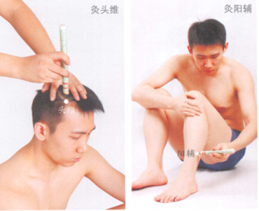 头痛的艾灸疗法