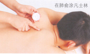 肺结核的艾灸疗法