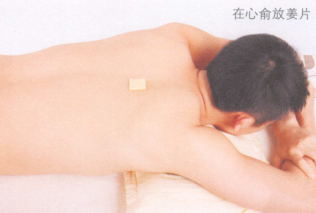 失眠的艾灸疗法