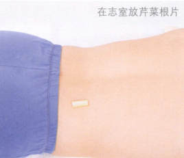 失眠的艾灸疗法