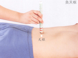 便秘的艾灸疗法