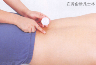 便秘的艾灸疗法