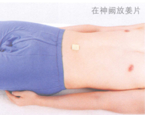 呕吐的艾灸疗法