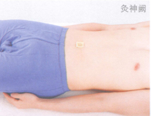 呕吐的艾灸疗法