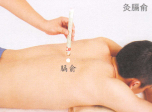 呃逆的艾灸疗法
