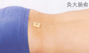 腹泻的艾灸疗法