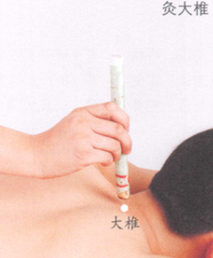 鼻出血的艾灸疗法