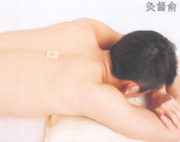 低血压的艾灸疗法