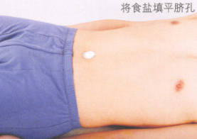 中暑的艾灸疗法