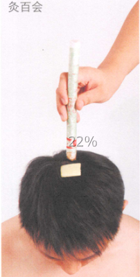 口腔溃疡的艾灸疗法