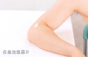 神经性皮炎的艾灸疗法