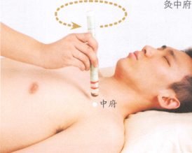 皮肤瘙痒症的艾灸疗法