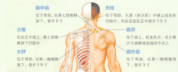 落枕的艾灸疗法