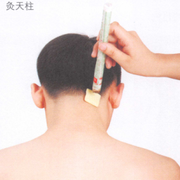 落枕的艾灸疗法