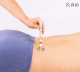 腰椎间盘突出的艾灸疗法