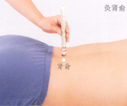 急性腰扭伤的艾灸疗法