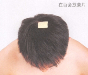 脱肛的艾灸疗法