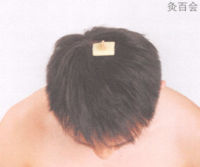 脱肛的艾灸疗法