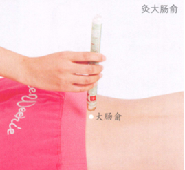 外阴瘙痒症的艾灸疗法