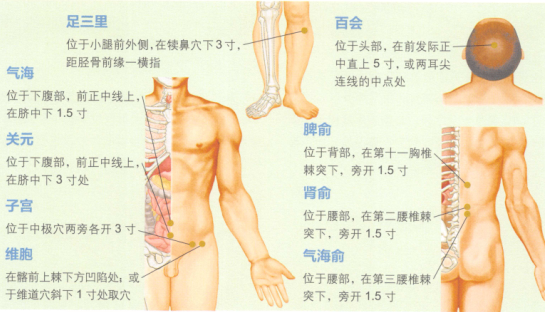 子宫脱垂的艾灸疗法