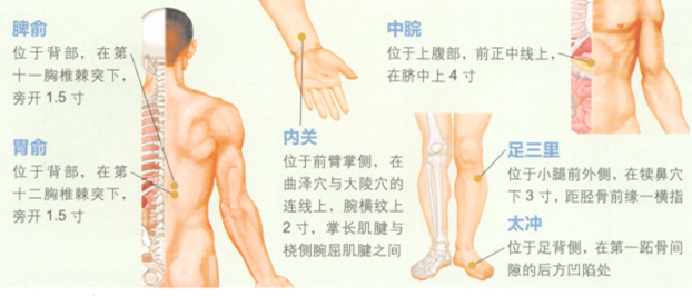 妊娠呕吐的艾灸疗法