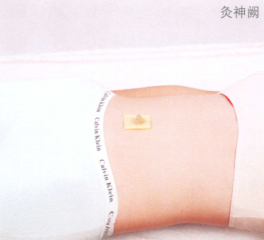 产后腹痛的艾灸疗法