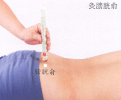 阳痿的艾灸疗法