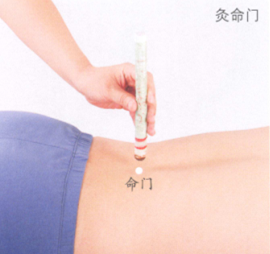 男性不育症的艾灸疗法