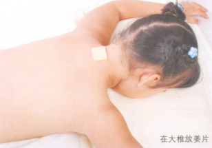 百日咳的艾灸疗法