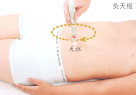 小儿腹泻的艾灸疗法
