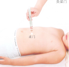 小儿厌食的艾灸疗法