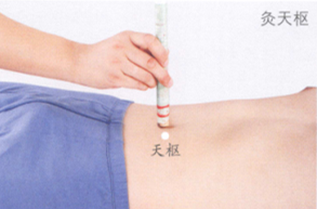 肥胖的艾灸疗法