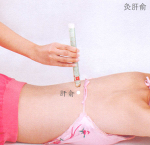 黄褐斑的艾灸疗法