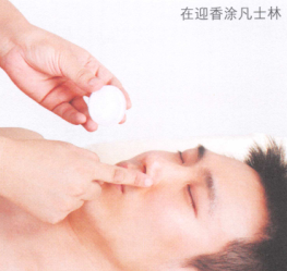 酒渣鼻的艾灸疗法