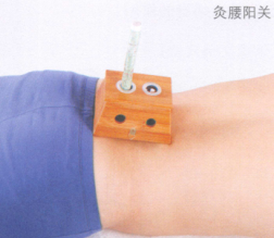 增加免疫力的艾灸疗法