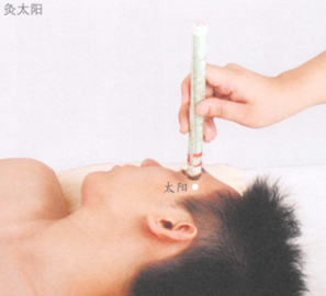 健脑益智的艾灸疗法