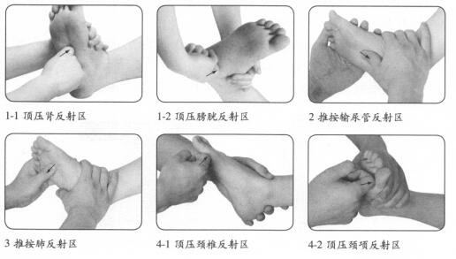 颈椎病的穴位按摩疗法