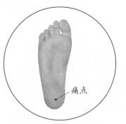 足跟痛的穴位按摩疗法