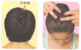 失眠的穴位按摩疗法