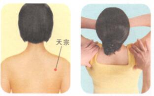 颈椎病的穴位按摩疗法