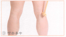 坐骨神经痛的穴位按摩疗法